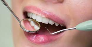 Matureia participa de pesquisa Nacional de Saúde Bucal