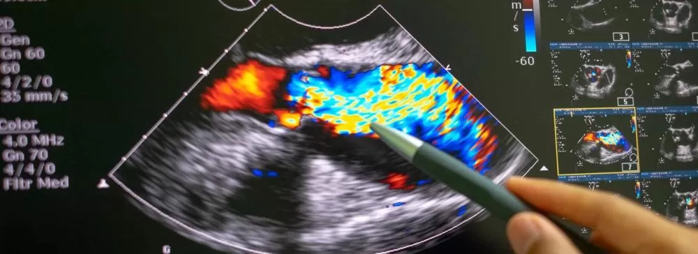 Prefeitura de São João do Rio do Peixe amplia serviços de saúde com exame de ultrassonografia com Doppler